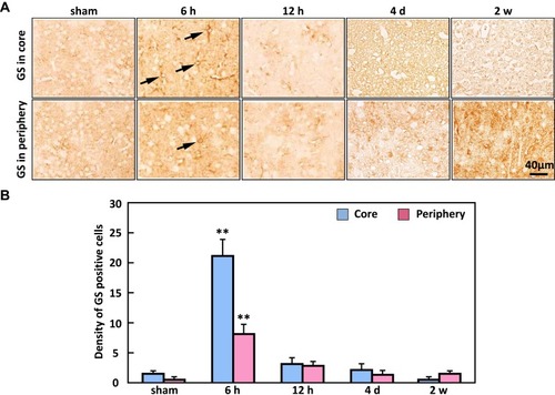 Figure 4 The expression of glutamine synthetase (GS) in the ischemic core and periphery regions of the cortex. (A) Representative immunostaining showed that GS-positive cells (arrows) were significantly increased at 6 h in both the core and periphery. (B) The density of glutamine synthetase peaked at 6 h in the ischemic core and periphery regions. Bar scale = 40 µm. n=20, **P < 0.01, compared to sham.