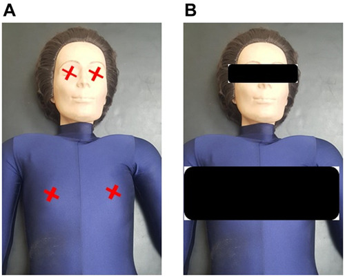 Figure 3 The anthropometric phantom shows the illustration of the external detector position to measure the absorbed dose in (A) without shielding and (B) with shielding.