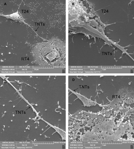 Figure 4 Micro-structures of TNTs between T24 and RT4 cells observed under SEM.Notes: TNTs (A, Black arrows) were observed between T24 and RT4 cells. Continuous, membranous, micro-tubular connection between T24 and RT4 cells are shown (B, C and D). The TNTs structures were fragile (D). The diameter of TNTs ranged from 200 to 500 nm, and the lengths of TNTs between T24 and RT4 cells ranged from 20 μm to 1 mm.Abbreviations: TNTs, tunneling nanotubes; SEM, scanning electron microscopic.