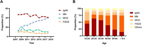 Figure 2. (A) Changing frequency of common histological categories in primary glomerular nephropathy over the study period. (B) The frequency of the most common histological categories in primary glomerular nephropathy based on different age groups. Abbreviation: IgAN: IgA nephropathy; MN: membranous nephropathy; MCD: minimal change disease; FSGS: focal segmental glomerulosclerosis.