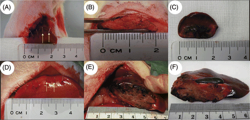 Figure 3. Animal studies in rats (A-C) and rabbits (D-F). Note that needle arrays were aligned along the resection lines (A and D, arrows). After resection, the surfaces of remnant liver were completely coagulated and no bleeding was noted after the operation (B and E). Using electromagnetic thermal therapy, a part of the median lobe of liver was resected successfully (C and F).