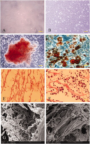Figure 3. Light microscopic images showed the adherent BMSCs having an appearance of a long fusiform or spindly in shape (A) and a typical gyrate growth when they reached at least 90% of fusion (B). The osteogenic and adipocyte differentiation potentials of BMSCs were verified by Alizarin Red S staining for calcium nodules (C) and Oil Red O staining for adipocytes (D), respectively. ASCS exhibited a regular reticular, interconnected porous structure and was observed by H&E staining (E) and SEM (G). The adhesion and proliferation of BMSCs in the 3D porous scaffolds were also observed by H&E staining (F) and SEM (H). Scale bar: A,B for 100 μm; C–F for 200 μm.