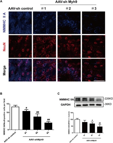 Figure 2 Efficacy of AAV-shMyh9 adenovirus transduction in vivo. 4 weeks after tail intravenous injection of AAV9-sh control-GFP or AAV9-shMyh9-GFP (#1, #2, #3), efficacy of AAV-shMyh9 adenovirus transduction were detected by immunofluorescence (A, B) and Western blot (C). Bar: 50 µm. The data are represented as means±SD of 3 individual experiments. #P<0.05 and ##P<0.01 vs the AAV9-sh control group.