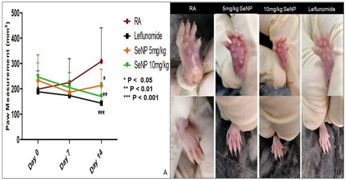 Figure 9 (A) Reduction in paw volume in 5mg/kg SeNP (P <0.05), 10mg/kg SeNP (P < 0.01) and leflunomide (P<0.001) treated groups as compared to arthritic control group. (B) Ventral and dorsal paw view of arthritic group compared to groups treated with 5mg/kg SeNP, 10mg/kg SeNP and leflunomide.Abbreviations: SeNP, selenium nanoparticles; RA, rheumatoid arthritis.