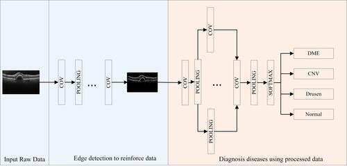 Figure 3 Working principle of the overall model (the primary features are obtained by training the model with other similar data and are fixed during the new training process. In addition, we use back propagation algorithms to relearn advanced features and classifiers in specific data. CNV means choroidal neovascularization, DME means diabetic macular edema, COV means convolution).