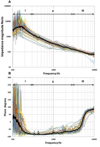 Figure 4 Individual magnitude (A) and phase (B) of the skull impedance of all the 45 subjects tested. The median value is presented by the thick black line. The impedances are divided in the analysis into a low-frequency region (I), a mid-frequency region (II) and a high-frequency region (III) depending on the phase characteristics.