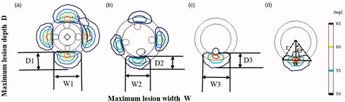 Figure 6. Illustration of lesion size using the different applicators. (a) Balloon-based RDN, (b) spiral RDN, (c) Monopolar-RDN, and (d) Lesion angle.