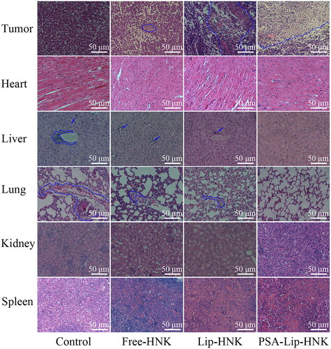 Figure 8. H&E staining photographs of tumors and main organs from different HNK treatment groups. The necrosis areas in tumor sections and metastasis lesions in liver and lung sections were circled by blue lines.