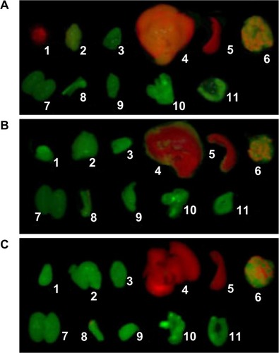 Figure 4 Ex vivo NIR fluorescence images of tumor and organs 12 hours after intravenous injection of QD800-RGD or QD800.