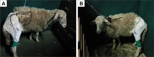 Figure 2 REAC TO-RGN treatment (A) right leg, (B) left leg.