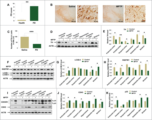 Figure 1. MPTP induces autophagy in the brain tissues of monkeys with MPTP treatment. Monkeys had a higher Parkinson disease (PD) score after MPTP injection compared to their status before the drug treatment (A). The number of TH-positive cells and dendrites of dopaminergic neurons was reduced in the SNc (B and C) and the protein levels of TH (D and E) were decreased in different brain tissues of monkeys treated with MPTP. There were increased protein levels of LC3B-II (F and G) and a decreased level of SQSTM1 (F, H). CDK5 levels were elevated (I and J), accompanied with increased levels of CDK5R1 (I, K), in different brain tissues of monkeys with MPTP treatment. *, P < 0.05; **, P < 0.01; ***, P < 0.001; Student t test. Bars represent mean ±SEM.