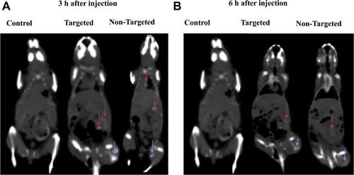 Figure 10 Coronal CT images of nude mice after intravenous injection of AuNPs and FA-Cys-AuNPs at 3 hours (A) and 6 hours (B) (blue arrows indicate the tumor site and red arrows indicate other sites). The injection of the AuNPs (either non-targeted or targeted) leads to an enhanced CT contrast of the tumor area, and 3 h post injection shows a maximum CT enhancement of the tumor area. Reprinted from Int J Biochem Cell Biol, 114, Khademi S, Sarkar S, Shakeri-Zadeh A, et al. Targeted gold nanoparticles enable molecular CT imaging of head and neck cancer: an in vivo study. 105554, Copyright 2019, with permission from Elsevier.Citation138