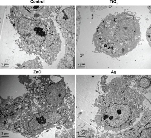 Figure 2 Representative TEM images of HASMCs.Note: HASMCs were exposed to 0 µg/mL (control), 16 µg/mL TiO2 NPs, 16 µg/mL ZnO NPs, or 16 µg/mL Ag NPs for 24 hours, and TEM was used to visualize ultrastructural changes in cells and internalization of NPs.Abbreviations: HASMCs, human aortic smooth-muscle cells; NPs, nanoparticles; TEM, transmission electron microscopy.