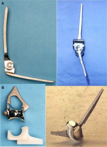 Figure 2 (A) Linked designs of TER. Left: Stanmore, right: Triaxial. (B) Unlinked design of TER. Left: Souter-Strathclyde, right: Kudo (type IV).