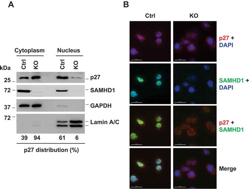 Figure 4. SAMHD1 KO inhibits nuclear localization of p27 in THP-1 cells. (a) THP-1 control and SAMHD1 KO cells were analyzed via subcellular fractionation followed by immunoblotting. GAPDH and Lamin A/C were used as markers for cytosolic and nuclear fraction, respectively. Results are representative of three independent experiments. (b) Cells were analyzed via indirect immunofluorescence for p27 (red) and SAMHD1 (green) expression. DAPI (blue) was used to stain the nuclei. Scale bars, 15 µm. Results are from one representative experiment of two independent assays.