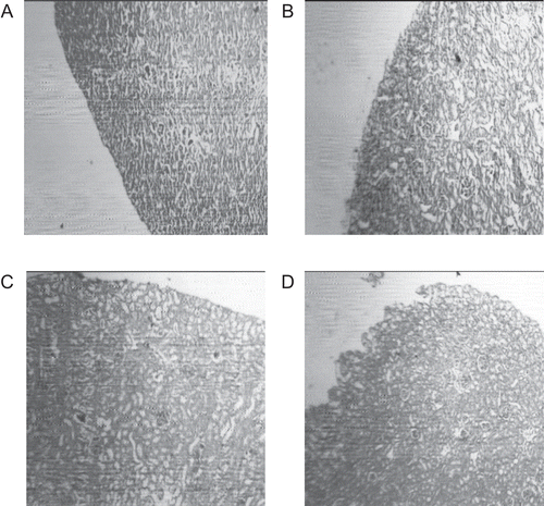 Figure 3.  Micrograph of kidney of mice (A) control, (B) 72 h of cisplatin injection, (C) cisplatin and Hemidesmus indicus, (D) cisplatin and Acorus calamus. The tissues were fixed in 10% formalin, embedded in paraffin, sectioned at 5 μm and stained with hematoxylin-eosin. The histopathological examinations were carried out using light microscopy (40×).