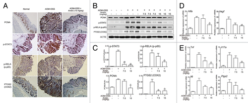 Figure 2. Andrographolide inhibits inflammation in a colitis-associated colorectal cancer model. Mice were subjected to the AOM-DSS model. For other details, see the legend of Figure 1. (A) The expression of PCNA, p-STAT3, p-RELA/p-p65, and PTGS2/COX2 were analyzed by immunochemistry in paraffin-embedded colon sections. Data shown are representative of 3 experiments. (B) The expressions of PCNA, p-STAT3, p-RELA, and PTGS2 in colonic tissues were examined by western blotting. (C) Statistical data of the expressions of protein from 3 mice were shown. (D and E) The mRNA expressions of Hif1a, Vegfa, Tnf, Il17a, Il6, and Ptgs2 in colon sections were determined by real-time PCR. Data are presented as means ± SEM (n = 6). *P < 0.05, **P < 0.01 vs. AOM+DSS group. Andro, andrographolide.