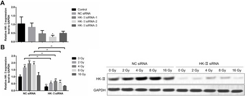 Figure 2 Verification of HK-II siRNA. (A) qRT-PCR results. (B) Western blotting results. (*p<0.05, **p<0.01, #p<0.05, ##p<0.01, and ^^p<0.01).