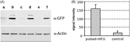 Figure 4. (A) Western blot analysis shows expression of GFP gene (top row) against that of α-actin (bottom row) in tissue samples from control tumors (a, c, e) and treated tumors (b, d, f). (B) Graph of results of densitometric analysis shows significant increase in GFP expression in tumors treated with pulsed high-intensity focused ultrasound (160.2 arbitrary units [au] ±24.5) compared with that in control tumors (17.4 au ± 11. 8) (paired Student t-test, P = 0.004). Values were normalized to those of the housekeeping gene, α-actin. (Citation[58] Reprinted with permission.)