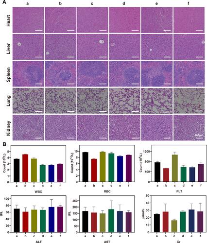 Figure 9 (A) H&E staining images of mice organs after 21-day treatment. (B) Blood parameters for evaluating effects on bone marrow hematopoietic system (RBC, WBC and platelet) and liver (ALT, AST) and kidney (Cr) function. Note that a–f represent the same treatments as Figure 8.