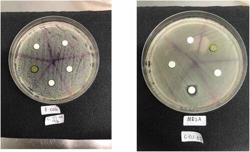 Figure 3. Examples of inhibition zones experiment.