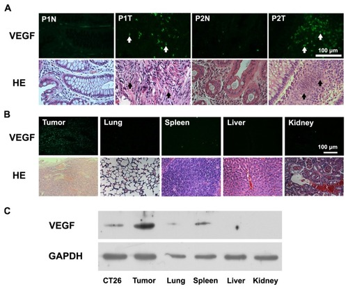 Figure 1 Strong expression of VEGF in human and mouse colon tumors as shown by immunofluorescent staining and Western blotting. (A) Serial sections from N and T in colon tumor specimens from P1 and P2 were stained for VEGF (upper panels) or with HE staining (lower panels). The arrows indicate VEGF expression colocalized with tumor cells. Scale bar = 100 μm. (B) Fluorescence and light microscopic images of mouse tumor sections. Serial sections from tumor, lung, spleen, liver, and kidney of CT26- bearing mice were stained for VEGF (upper panels) or HE (lower panel). Scale bar = 100 μm. (C) VEGF levels in CT26 cell lysates and in tissue lysates from tumor, lung, spleen, liver, and kidney of CT26-bearing mice measured by Western blotting. GAPDH was used as the loading control.Abbreviations: GAPDH, glyceraldehyde-3-phosphate dehyodrogenase; HE, hematoxylin and eosin; N, normal tissue; P, patient; T, tumor tissue; VEGF, vascular endothelial growth factor.