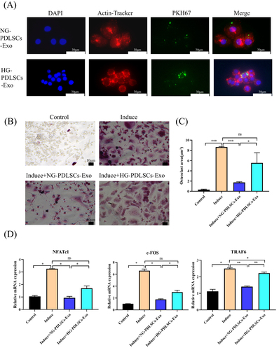 Figure 3 The effect of NG-PDLSCs-Exo and HG-PDLSCs-Exo on osteoclast differentiation of macrophages. (A) Uptake of NG-PDLSCs-Exo and HG-PDLSCs-Exo by RAW264.7 cells. Blue represents the nucleus stained with DAPI, red represents the cell membrane stained with a red fluorescent probe from a microfilament, and green represents Exo stained with the PKH67. Scale bar: 30 μm. (B) RAW264.7 cells were co-cultured with (15 μg/mL) NG-PDLSCs-Exo or HG-PDLSCs-Exo and osteoclast induction was performed at the same time. Red multinucleated giant cells appear via TRAP staining. Scale bar: 10 μm. (C) Statistics of osteoclasts area. (D) The levels of NFATc1, c-FOS and TRAF6 genes in RAW264.7 cells induced by M-CSF and RANKL were detected by qRT-PCR. Data are shown as the mean ± SD of three independent experiments. Statistical analyses were performed by ANOVA. *P<0.05, **P<0.01, ***P<0.001, ns indicates no statistical significance.