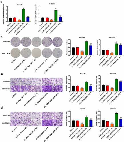 Figure 6. LRP4 overexpression inhibited the inhibitory role of silencing HUMT on HCC proliferation, migration, and invasion. (a) QRT-PCR assay was applied to detect LRP4 expression in HCCLM3 and MHCC97H cells. (b) Proliferation of HCCLM3 and MHCC97H cells was assessed using colony formation asssay. (c, d) The transwell assay was used to assess HCCLM3 and MHCC97H cell migration (c) and invasion (d). **P < 0.01 vs. Control and si-NC+pcDNA3.1-NC. ##P < 0.01 vs. si-HUMT+pcDNA3.1-NC. &P < 0.05 and &&P < 0.01 vs. si-NC + pcDNA3.1-LRP4.