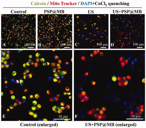 Figure 9. The mPTP opening via ultrasound combined with PSP@MB. (A) Control group, (B) PSP@MB group, (C) US group, (D) US + PSP@MB group, (E) Control group (enlarged), and (F) US + PSP@MB group (enlarged). The OCSCs were stained with Mito Tracker Red CMXRos and Calcein. The cytosolic calcein fluorescence was quenched by adding CoCl2. When there is mPTP opening, the CoCl2 could enter the mitochondria and therefore also quench the mitochondrial calcein fluorescence in the US + PSP@MB group.