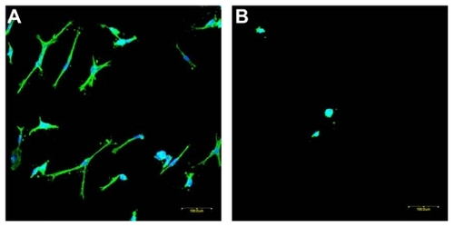 Figure 8 Immunofluorescence staining of human dermal fibroblasts on ENSs of (A) PDGF and RGDS conjugated and (B) blank. Images were recorded by a confocal microscope. The same magnification was used for both pictures. Bar: 100 μm.Abbreviations: ENS, electrospun nanofibrous scaffold; PDGF, platelet-derived growth factor; RGDS, Arg-Gly-Asp-Ser.