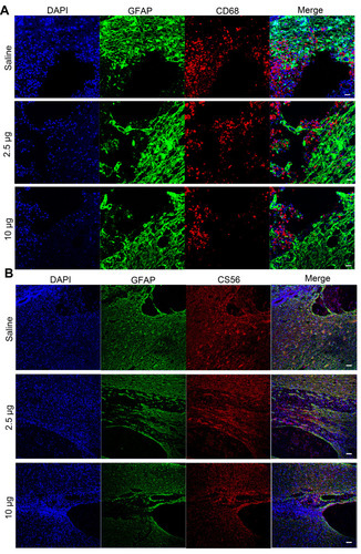 Figure 6 Immunoﬂuorescence images showing the mechanism underlying the Se-CQDs-mediated promotion of behavioral functional recovery. (A) Immunoﬂuorescence images highlighting the anti-inflammatory properties of Se-CQDs. Scale bar = 50 μm. (B) Immunoﬂuorescence images showing the inhibition of glial scars. Scale bar = 50 μm.