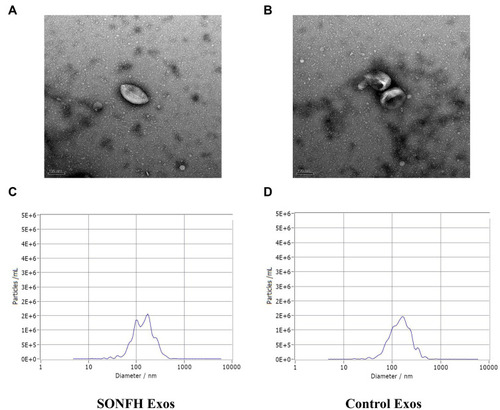 Figure 1 Characterization of plasma exosomes. (A and B) Transmission electron microscopy (TEM) image showed the morphology of plasma exosomes in steroid-induced osteonecrosis of the femoral head (SONFH) patients and healthy control subjects. (C and D) The nanoparticle tracking analysis (NTA) was used to estimate particle size distribution of plasma exosomes in SONFH patients and healthy control subjects.