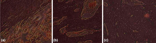 Figure 6. Histological Slice of Experiment Group. a. 2 weeks later, the gelatin began degrading, a little bony callus forming; b. 8 weeks later, the gelatin basically degraded, a large quantity of bony callus forming; and c. 12 weeks later, the gelatin completely degraded, the osteocytes growing actively, bony union being good.