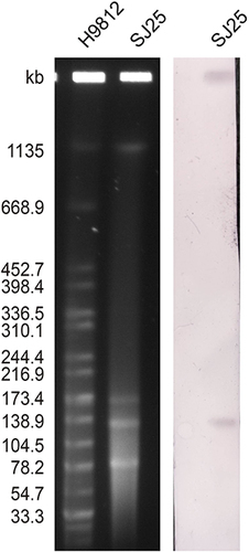 Figure 1 Plasmid profiles and Southern blot-hybridization of K. pneumoniae strain SJ25. Southern blot-hybridization of S1-nuclease digested DNA using a specific probe (blaKPC). M: XbaI digested total DNA of Salmonella enterica serotype Braenderup H9812 as a size marker.