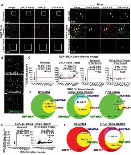 Figure 2. Secreted LGALS3 and DSP-SNCA colocalize with exogenously added SNCA fibrils. (A) A representative z-stack from a constructed z-stack MIP obtained from the cultured media of untreated HeLa DSP-SNCA and those treated with SNCA fibrils. Representative MIPs of z-stack images for cultured media obtained from untreated HeLa DSP-SNCA processed for immunofluorescence without the primary antibody (2° Ab treatment) are also given. The white arrows point to DSP-SNCA+, LGALS3+ double-positive events in untreated and DSP-SNCA+, LGALS3+, SNCA Fibril+ triple-positive events in the SNCA fibril treated conditions. (B) Demonstration of the Spots masking algorithm built around the DSP-SNCA channel from a z-stack MIP showing specificity for the desired channel. (C) Representative colocalization plots of the maximum fluorescence intensities of the LGALS3 (y-axis) and SNCA fibril (x-axis) signal found within each DSP-SNCA masking algorithm Spot pooled from a total of 15 images from a single treatment conditions’ coverslip. Each data point represents a single recognized DSP-SNCA+ spot within an image. Quadrant numbers indicate the percent colocalization of DSP-SNCA+ where the relative background signal was determined based on the LGALS3 and SNCA fibril maximum intensity signal measured in the 2° antibody control condition. The percent single DSP-SNCA+ positive, DSP-SNCA+ SNCA fibril+ double positive, DSP-SNCA+ LGALS3+ double positive, and DSP-SNCA+ SNCA fibril+ LGALS3+ triple positive are given in the bottom left, bottom right, top left, and top right quadrants, respectively. (D) Summarized average colocalization of DSP-SNCA+ masking algorithm Spots from four independent experiments. DSP-SNCA+ Spots that are single positive (green), DSP-SNCA+ SNCA fibril+ double positive (cyan), DSP-SNCA+ LGALS3+ double positive (yellow), and DSP-SNCA+ SNCA fibril+ LGALS3+ triple positive (white). (E) Representative colocalization plots of the maximum fluorescence intensities of the DSP-SNCA (y-axis) and SNCA fibril (x-axis) signal found within each LGALS3 masking algorithm Spot from the same images set of images. Colocalization plots are from a single image. The percent single LGALS3+ positive, LGALS3+ SNCA fibril+ double positive, LGALS3+ DSP-SNCA+ double positive, and LGALS3+ SNCA fibril+ DSP-SNCA+ triple positive are given in the bottom left, bottom right, top left, and top right quadrants, respectively. (F) Summarized average colocalization of LGALS3+ masking algorithm Spots from four independent experiments. LGALS3+ Spots that are single positive (red), LGALS3+ SNCA fibril+ double positive (magenta), LGALS3+ DSP-SNCA+ double positive (yellow), and LGALS3+ DSP-SNCA+ SNCA fibril+ triple positive (white). Summarized average colocalization of (D) DSP-SNCA or (F) LGALS3 masking algorithm Spots from four independent experiments. The degree of colocalization of DSP-SNCA or LGALS3 with the respective other channels was determined based on the background signal measured in the 2° Ab control. Data are expressed as M ± SE (n = 4 coverslips, where M was determined from 15 images).