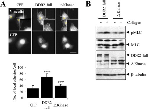 Figure 2. Inhibition of DDR2 activation reduces formation of focal adhesion. (A) HeLa cells were expressed with designated plasmid for 24 h. After 16 h serum starvation, cells were treated with 50 µg/mL Type I collagen for 2 h and stained using an anti-vinculin antibody to visualize focal adhesions. (B) HeLa cells transfected with full and Δkinase DDR2 constructs were lysed and subjected to SDS-PAGE followed by anti-phospho-MLC (serine 19), anti-pan-MLC, anti-myc, and anti-β-tubulin antibodies. Cells that expressed Δkinase DDR2 inhibited the phosphorylation of MLC induced by collagen stimulation. ***P < 0.001, Student's t-test.