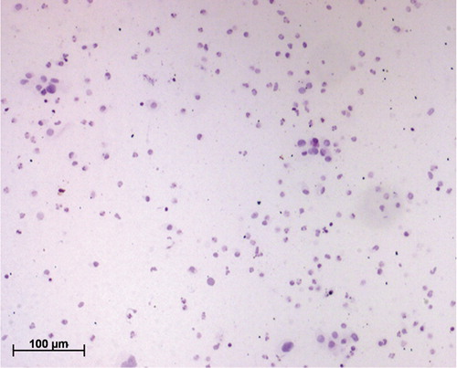 Figure 2. Hematoxylin-stained cervical smear treated with mucolyte; note the clearing of mucus and improved visibility of cells.