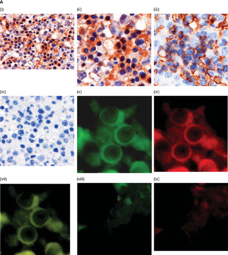 Figure 1. Effect of EPO on hSR-BI/CLA-1 expression. A: hSR-BI/CLA-1 expression in human bone-marrow cells. Immunohistochemical localization of hSR-BI/CLA-1 in normal human bone-marrow is shown. Immunoperoxidase staining of hSR-BI/CLA-1 (i) (×200), (ii) (×400), or anti-glycophorin-A (iii) (×400) is present in the cytoplasm or membrane of erythroblasts, and tissue stained with control IgG (iv) (×400) is negative. The blue staining as counterstain is hematoxylin staining. Localization of the hSR-BI/CLA-1 and GLY-A in normal erythroid cells were observed by fluorescence microscopy. Sections were double-stained with anti-hSR-BI/CLA-1 and anti-GLY-A labeled with FITC and Texas-Red, respectively, as described in the Materials and methods section. The expression of hSR-BI/CLA-1 (green) (×400) (v) and GLY-A (red) (×400) (vi) was observed in the cells from a bone-marrow aspirated sample. Co-localization of hSR-BI/CLA-1 and GLY-A in the same cells was shown by merged images (yellow) (×400) (vii). Tissue stained with control IgM (viii) or IgG (ix) (×400) as the first antibody is negative. B, C: Effect of EPO on hSR-BI/CLA-1 protein (B) or mRNA (C) expression in HEL cells. HEL cells were incubated in the presence or absence of EPO for 24 hours. Control HEL cells were incubated in the absence of EPO. hSR-BI/CLA-1 protein or mRNA was detected by Western blot analysis probed with an anti-CLA-1 antibody or real-time PCR method, respectively. Abundance of GAPDH served as a control and is shown at the bottom of each lane (Cont = control; EPO(1) = 1 U/mL EPO; EPO(10) = 10 U/mL EPO). The ratio of hSR-BI/CLA-1/GAPDH or hSR-BI/CLA-1/β-actin is shown as per cent of control in the figure. Each data point shows the mean and SEM (n = 3) of separate experiments. The asterisk denotes a significant difference with that in the control HEL cells (cont) (P < 0.05).