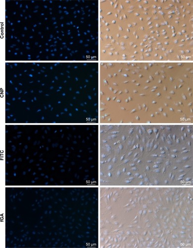 Figure 11 In vitro cellular release of fGA (green) from CNPs into 786-O cells.Notes: DAPI was used to stain the cell nucleus (blue). Gradual increase in fluorescence was observed from 30 minutes to 48 hours treatment point with fGA-CNP. No green fluorescence was observed in cells treated with CNP, fluorescein 5(6)-isothiocyanate, and fGA. (Images were acquired at 100× magnification with 50 µm scale bar).Abbreviations: CNP, chitosan nanoparticle; DAPI, 4,6-diamidino-2-phenylindole dihydrochloride; fGA, fluorescently labeled glutamic acid.