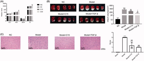 Figure 1. CT attenuates the infarct region in the MCAO model. (A) The serum levels of alanine transaminase (ALT), aspartate aminotransferase (AST), blood urea nitrogen (BUN), and creatinine (Cr) were assessed to evaluate hepatorenal function. * p < 0.05 vs. NC, *** p < 0.001 vs. NC. (B) The infarct region of rats subjected to MCAO and CT treatments were examined by the triphenyltetrazolium chloride (TTC)-stained assay. *** p < 0.001 vs. NC; ## p < 0.01 vs. Model, ### p < 0.001 vs. Model;! p < 0.05 vs. Model + C15 (C) Haematoxylin-eosin (HE) stained serial coronal brain sections from rats subjected to MCAO and CT treatments. Magnification, 200 ×. *** p < 0.001 vs. NC; ## p < 0.01 vs. NC; ### p < 0.001 vs. Model.