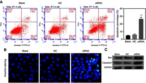 Figure 3 Knockdown of circLMNB1 accelerated the apoptosis of LoVo cells. The apoptosis of LoVo cells with circLMNB1 knockdown was assessed by flow cytometry (A) and Hoechst staining (B). (C) Knockdown of circLMNB1 induced upregulation of Bax and caspase-3. **P<0.01 vs NC group.