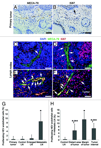 Figure 5. Proliferation rates of the HEV endothelial cells in primary tumor and LNs from OPSCC patients. (A and B) Consecutive sections of a primary tumor, HEVs, and proliferating cells were detected by MECA-79 staining (A) and proliferating marker Ki67 staining (B), respectively. Arrow, the proliferating endothelial cells of HEVs. (C–F) Staining of the proliferating endothelial cells in HEVs (arrows) in reactively-enlarged LN (C), the distant region of metastasis (D), the margin of metastatic tumor lesion (E) and the internal of tumor lesion (F) in metastatic LNs by MECA-79 (green), Ki67 (red), and DAPI (blue). Bar, 50 μm (A–F). (G) The proliferating rates of HEV endothelial cells in primary tumor and LNs. *P < 0.001 vs. control. (H) The proliferating rates of HEV endothelial cells in metastatic LNs. *P < 0.05 vs. control; **P < 0.05 vs. the margin of metastatic tumor lesion.