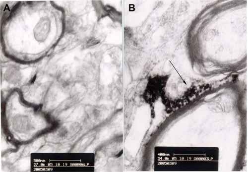 Figure 9 Transmission electron microscopic images of lanthanum nitrate-perfused rat brain.Notes: (A) Control rats; bar 500 nm. (B) Rats treated with methotrexate-liposome-coupled microbubbles and ultrasound showing lanthanum deposition outside the basement membrane of the vascular wall. The arrow shows lanthanum deposition between the nerve fibers; bar 400 nm.