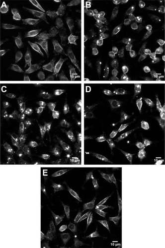 Figure 5 URI images of L929 fibroblasts at 1000× magnification (scale bar: 10 μm), after 24 h exposure to 0.5 mg/L of TiO2 NPs (sample A.5) in different media.Notes: (A) Control cells not exposed to NPs. (B) Protein-free. (C) HSA. (D) Glb. (E) Fib. Bright spots are NPs/agglomerates either internalized or attached to the cell membrane.Abbreviations: URI, ultra-high resolution imaging; h, hours; NPs, nanoparticles; HSA, human serum albumin; Glbs, γ-globulins; Fib, fibrinogen.