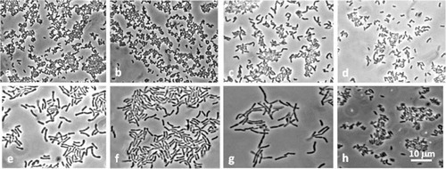 Fig. 2 Morphology of Bifidobacteriaceae isolates. S. inopinata: a, BR134; b, BR203. P. denticolens: c, BR278; d, BR281. B. dentium: e, BR317; f, BR318. B. infantis-longum: g, BR184. Unidentified Bifidobacteriaceae: h, BR191.