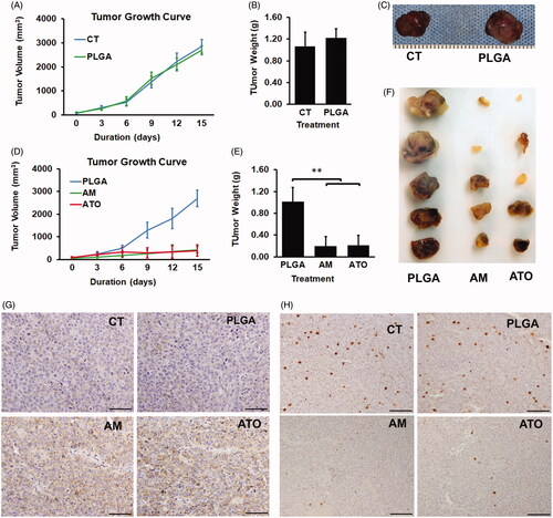 Figure 5. Locoregional delivery of AM and ATO on Huh7 HCC subcutaneous model significantly inhibited tumor growth through induction of apoptosis and inhibition of proliferation. The locoregional delivery of AM (2 mg/kg), ATO (2 mg/kg), vacant microsphere (PLGA), or PBS as control (CT) was through intratumoral injection (every three days for 15 days) on Huh7 subcutaneous mice model. (A–C). PLGA did not inhibit tumor growth as indicated in (A) tumor volume, (B) tumor weight at the time of harvest, and (C) representative picture of tumor at the time of harvest (data: mean ± SD; **p<.01). (D–E) Both AM and ATO demonstrated markedly antitumoral effects as indicated in (D) tumor volume, (E) tumor weight at the time of harvest, and (F) representative picture of the tumor at the time of harvest (data: mean ± SD; **p<.01). No difference on tumor volume and weight was noticed between AM and ATO. The effects of AM and ATO on apoptosis and proliferation were evaluated by immunohistochemical stains of (G) caspase-3 and (H) Ki-67 on tumor tissue. Both CT and PLGA showed the same caspase-3 and Ki-67 signal intensity. Compared to CT and PLGA, AM, and ATO significantly induced caspase-3 activity and inhibited Ki-67 expression. No difference between AM and ATO in term of caspase-3 activation and Ki-67 expression. Bar = 100 μm.