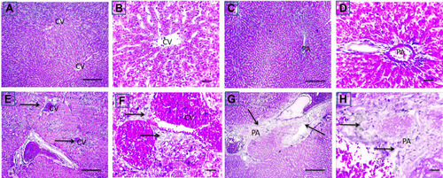 Figure 7 Effect of CP on fibrosis in CP-induced liver injury. Representative microscopic pictures of Masson trichrome stained liver sections, showing no collagen deposition around central vein (CV) and in portal areas (PA) scored 0 in cont group (A and B) and GL group (C and D). Meanwhile, a moderate stain (E and F) scored 2 to severe (G and H) scored 3 blue stained collagen deposition around central vein (CV) and in portal areas (PA) (black arrows) in group received cisplatin only (E–H). X: 100 bar 100 (A, C, E, and G) and X: 400 bar 50 (B, D, F, and H).