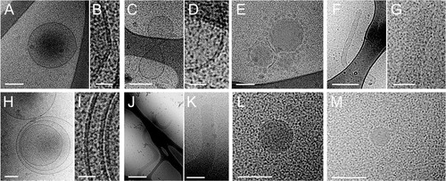 Fig. 1 Cryo-EM images of EV in platelet-rich plasma.Differently shaped particles were observed by cryo-EM: round (A) or oddly shaped (C) empty particles with a clear lipid bilayer (resp. B, D) and electron dense vesicles surrounded by smaller spherical structures (E). Also, large elongated empty vesicles (F, G), multilayered vesicles (H, I) and elongated (presumably actin) filled vesicles (J, K) were observed. Electron dense particles, which are likely lipoprotein particles, are observed frequently (L, M). Scale bars are 25 nm (B, D, I), 50 nm (G), 100 nm (A, C, E, H, K, L, M), 250 nm (F) and 500 nm (J).