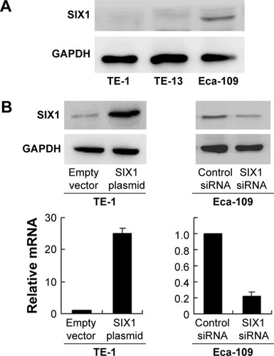 Figure 2 Expression of SIX1 in esophageal squamous cell carcinoma cell lines and its transfection and knockdown efficiency.