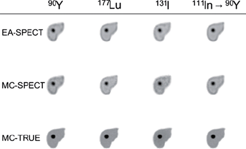 Figure 1. Absorbed dose rate images calculated from a) the assumption of local average energy deposition from charged particles within the voxel where the decay occur (EA-SPECT), b) a full Monte Carlo simulation of the energy deposition using activity distribution from quantitative SPECT images (MC-SPECT) and c) a full Monte Carlo from the true high-resolution activity distribution (MC-TRUE).